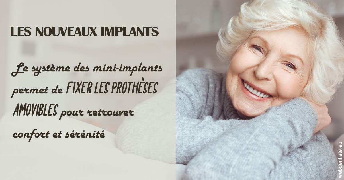 https://www.cabinet-dentaire-lorquet-deliege.be/Les nouveaux implants 1