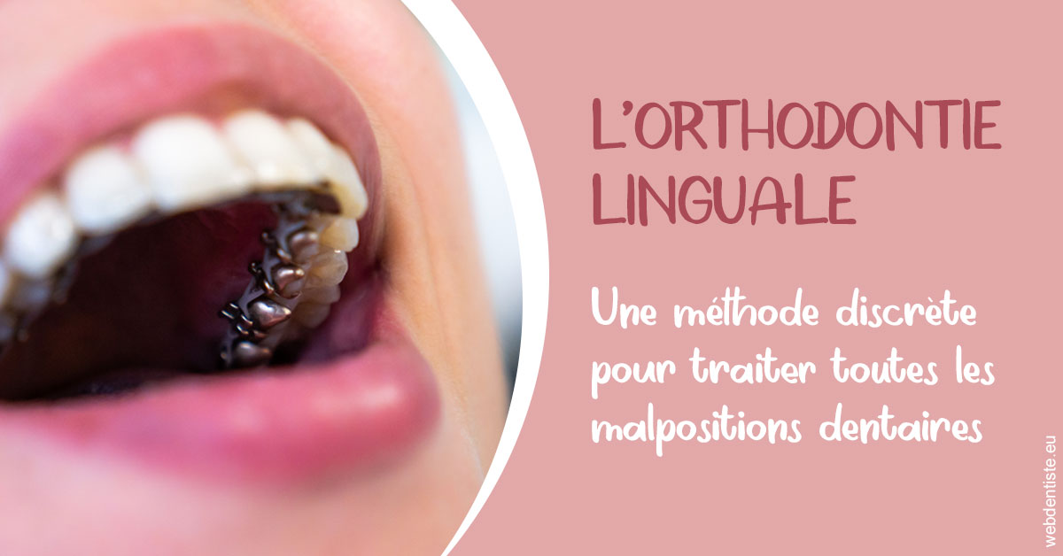 https://www.cabinet-dentaire-lorquet-deliege.be/L'orthodontie linguale 2