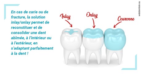 https://www.cabinet-dentaire-lorquet-deliege.be/L'INLAY ou l'ONLAY