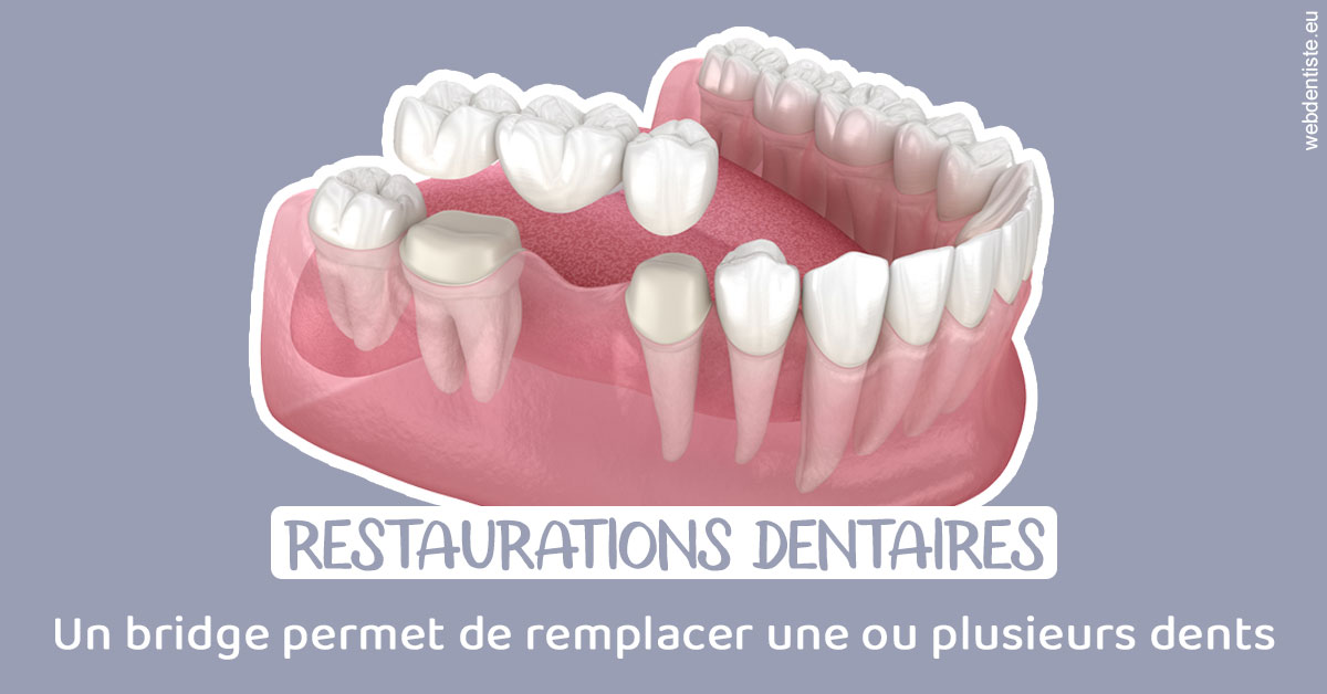 https://www.cabinet-dentaire-lorquet-deliege.be/Bridge remplacer dents 1
