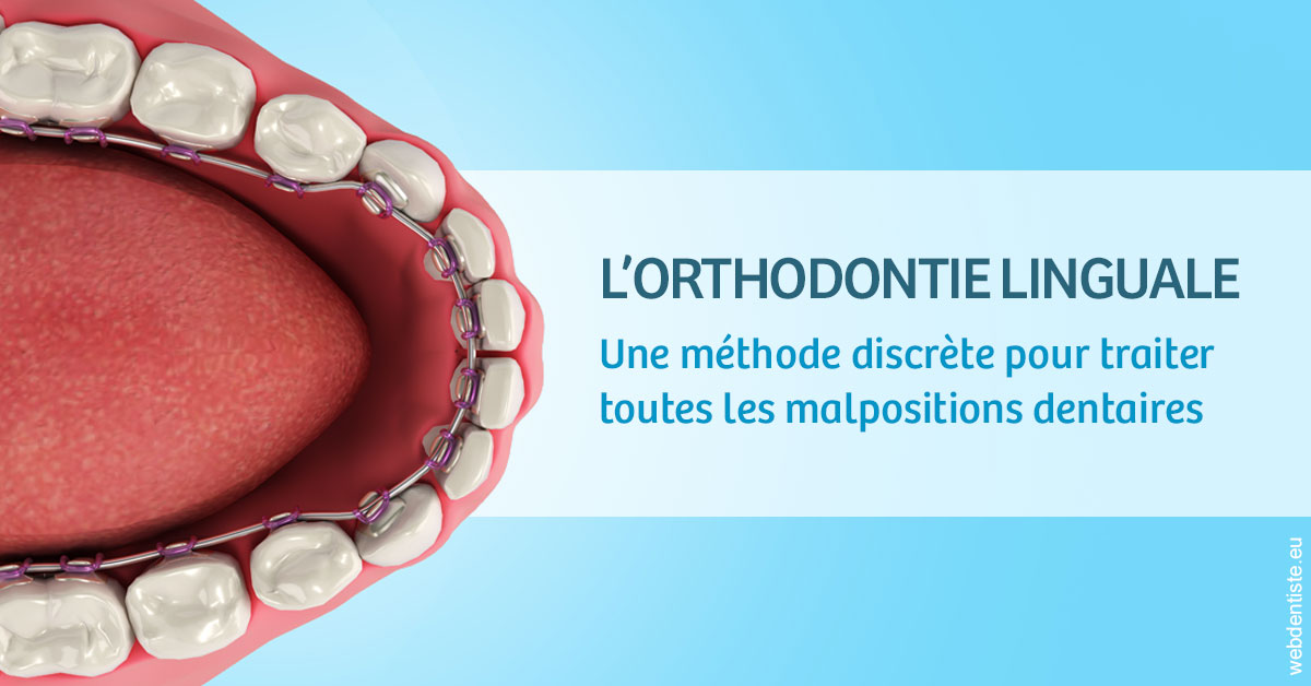 https://www.cabinet-dentaire-lorquet-deliege.be/L'orthodontie linguale 1