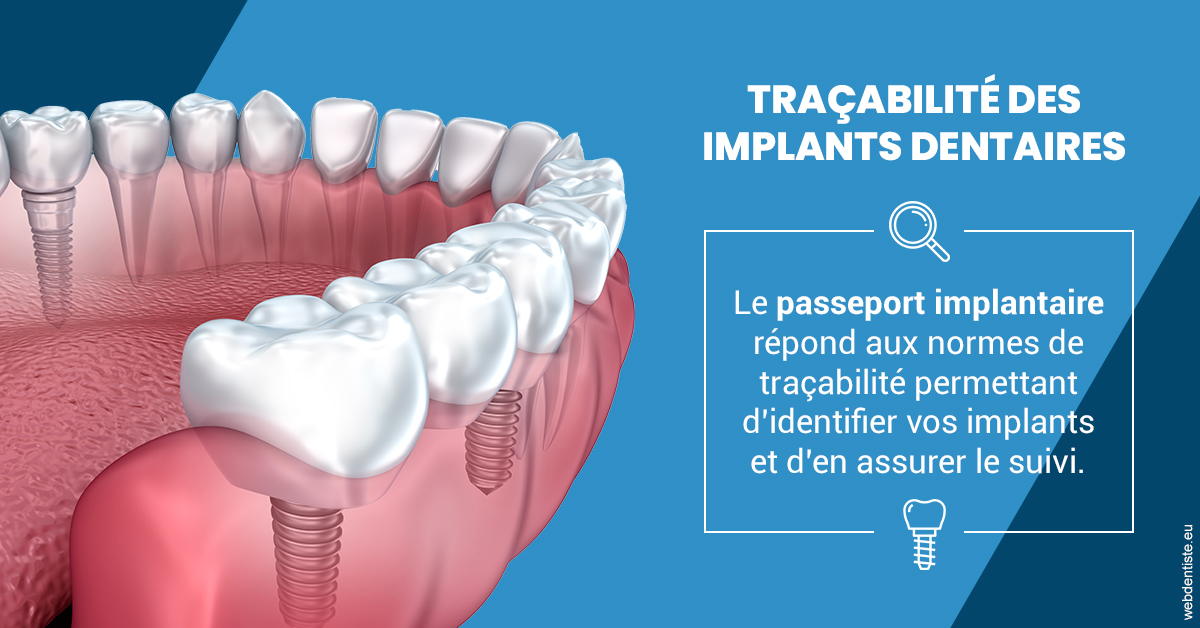 https://www.cabinet-dentaire-lorquet-deliege.be/T2 2023 - Traçabilité des implants 1