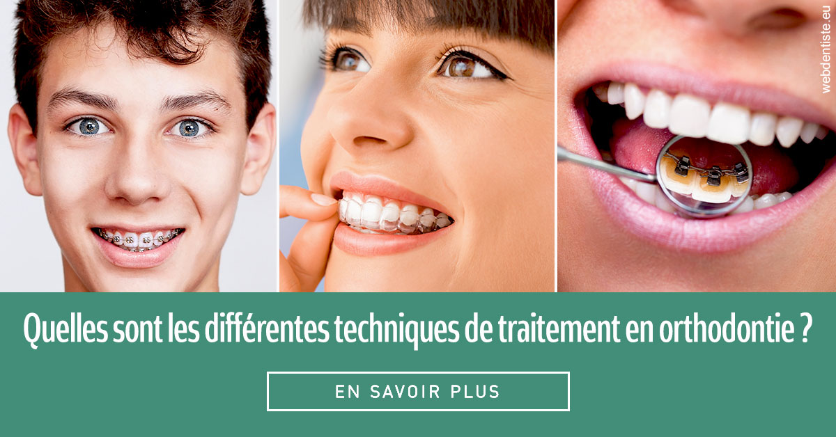 https://www.cabinet-dentaire-lorquet-deliege.be/Les différentes techniques de traitement 2