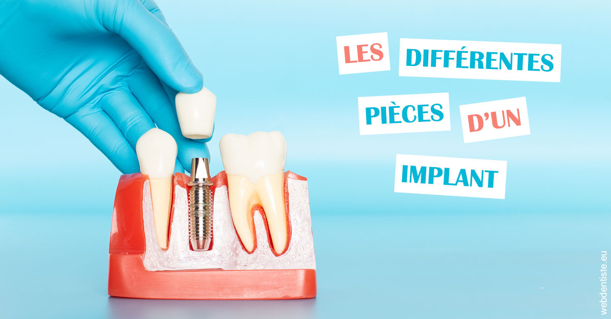 https://www.cabinet-dentaire-lorquet-deliege.be/Les différentes pièces d’un implant 2