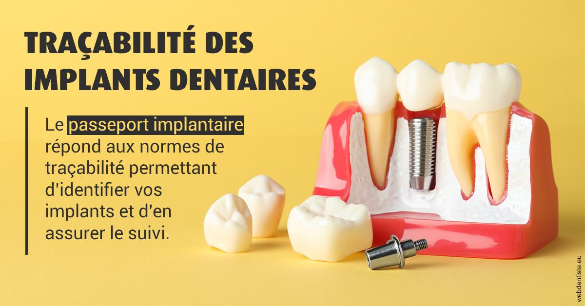 https://www.cabinet-dentaire-lorquet-deliege.be/T2 2023 - Traçabilité des implants 2