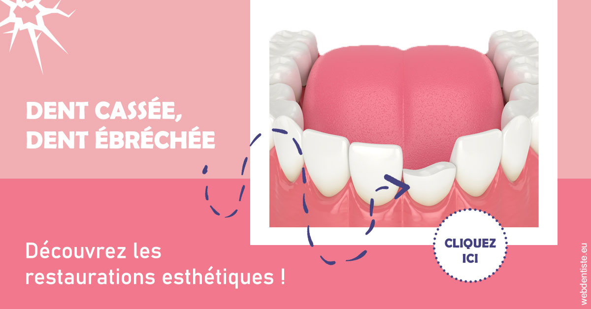 https://www.cabinet-dentaire-lorquet-deliege.be/Dent cassée ébréchée 1