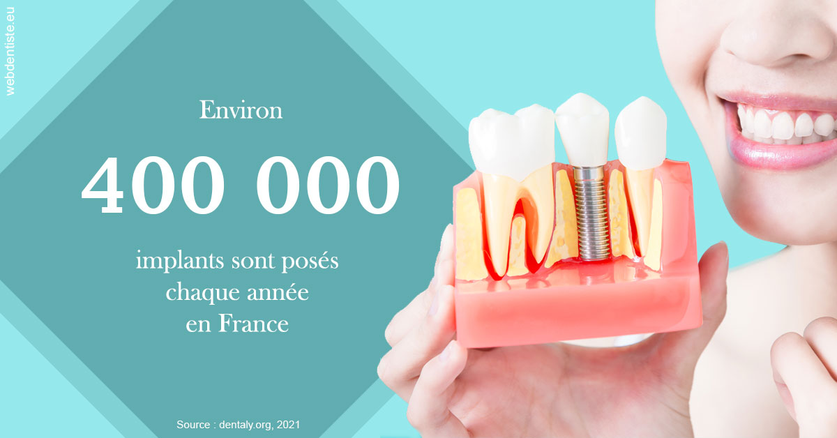 https://www.cabinet-dentaire-lorquet-deliege.be/Pose d'implants en France 2