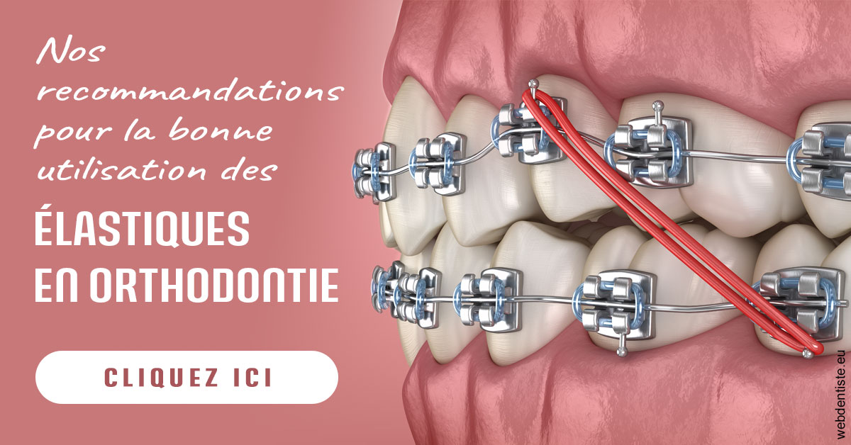 https://www.cabinet-dentaire-lorquet-deliege.be/Elastiques orthodontie 2