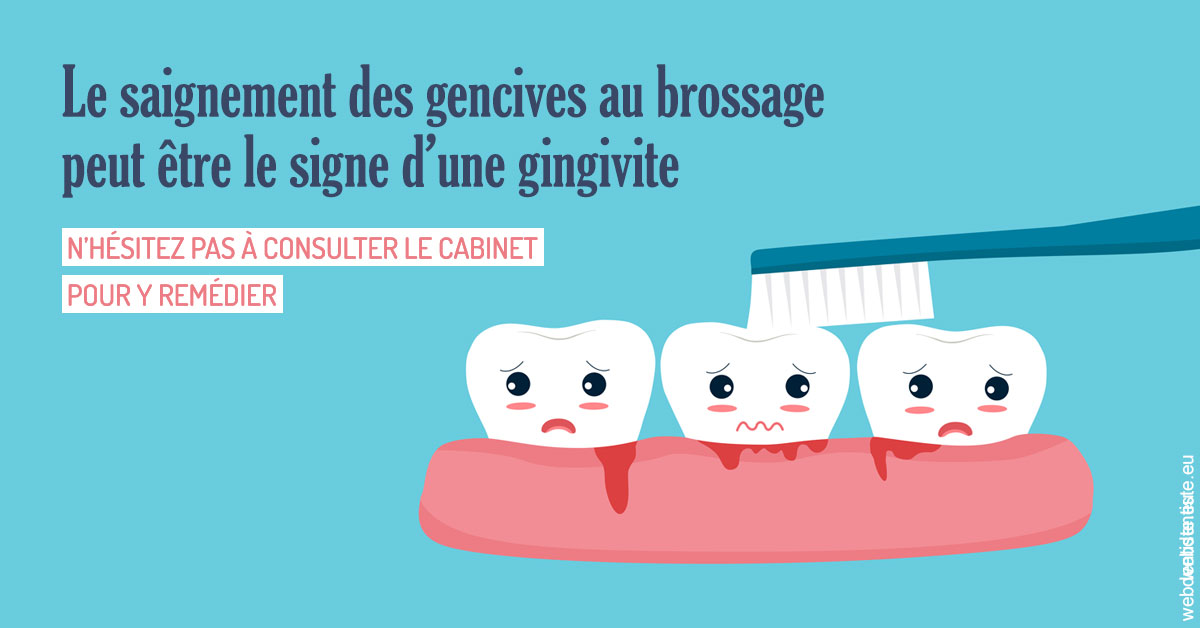 https://www.cabinet-dentaire-lorquet-deliege.be/2023 T4 - Saignement des gencives 02